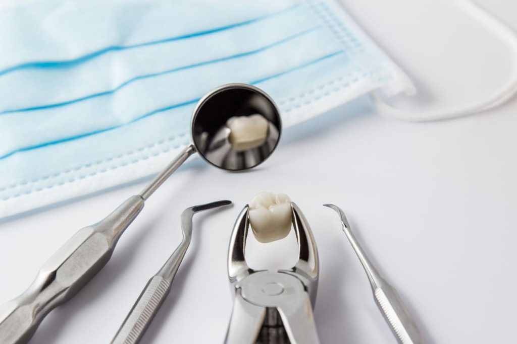 quando e come togliere i denti del giudizio 