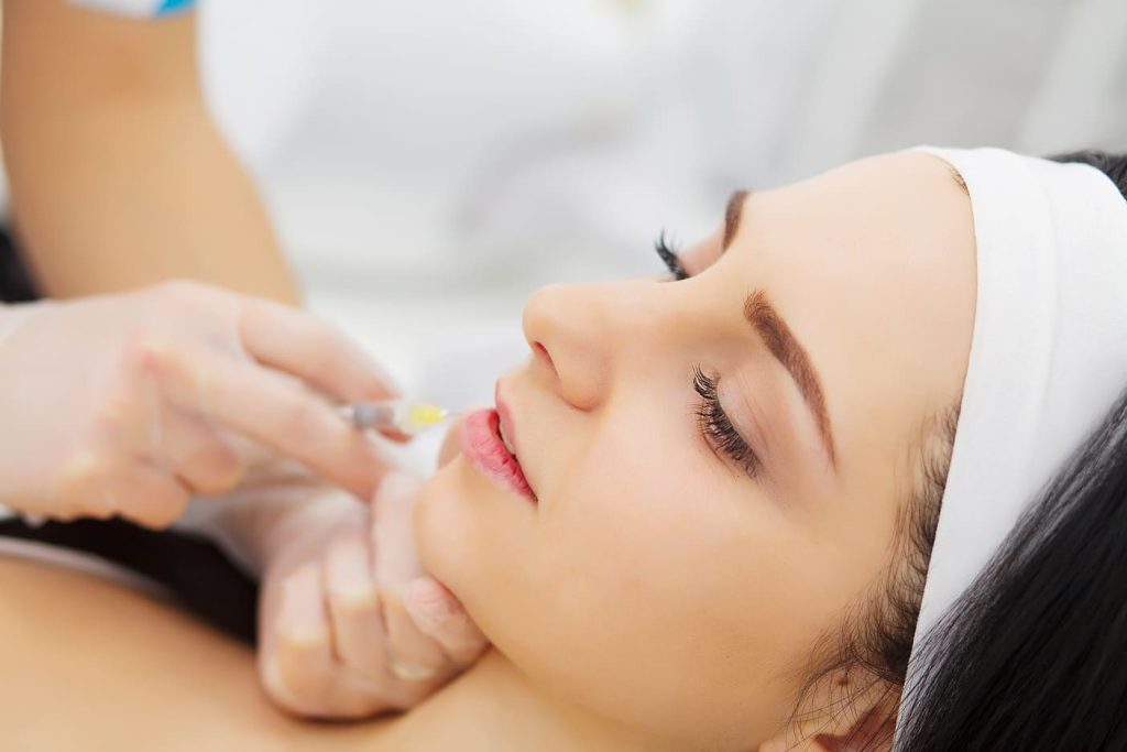 quanto dura il filler alle labbra