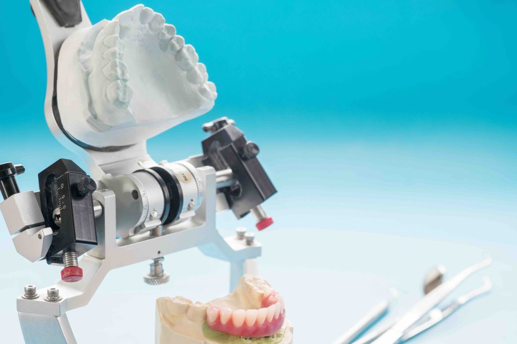 Implantologia casi complessi