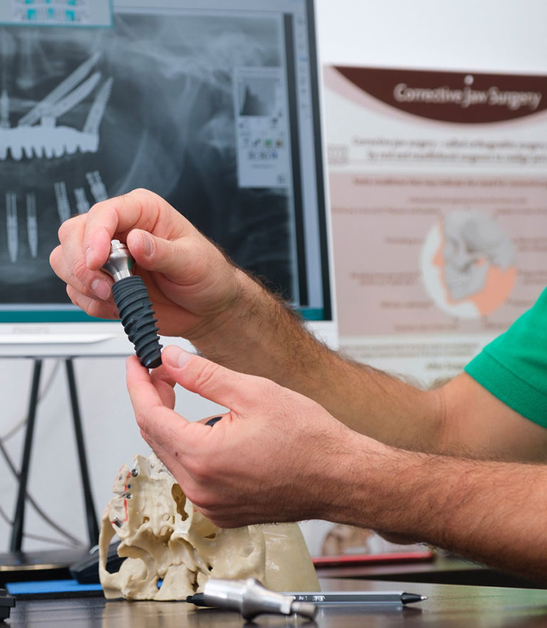 quanto dura un impianto dentale